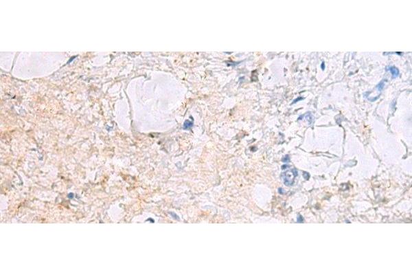 DPCD antibody