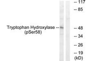 Western blot analysis of extracts from 293 cells treated with paclitaxel 1uM 24h, using Tryptophan Hydroxylase (Phospho-Ser58) Antibody. (Tryptophan Hydroxylase 1 antibody  (pSer58))