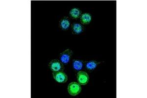 Image no. 1 for anti-Aldo-Keto Reductase Family 1, Member B1 (Aldose Reductase) (AKR1B1) (AA 287-316), (C-Term) antibody (ABIN357880) (AKR1B1 antibody  (C-Term))