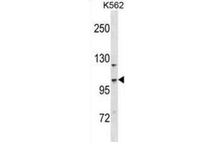 Western Blotting (WB) image for anti-Coiled-Coil and C2 Domain Containing 1A (CC2D1A) antibody (ABIN2998622) (CC2D1A antibody)