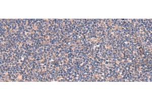 Immunohistochemistry of paraffin-embedded Human tonsil tissue using GALK2 Polyclonal Antibody at dilution of 1:95(x200) (GALK2 antibody)