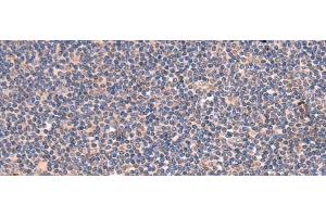 Immunohistochemistry of paraffin-embedded Human tonsil tissue using GALK2 Polyclonal Antibody at dilution of 1:95(x200) (GALK2 antibody)