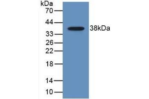 Detection of Recombinant MDC, Human using Monoclonal Antibody to Macrophage Derived Chemokine (MDC) (CCL22 antibody  (AA 25-93))
