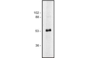 Western blot of human Jurkat T cell line (Alpha, beta-Tubulin Dimer antibody)