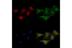 ABIN6266015 and ABIN6278800 staining Hela cells by IF/ICC. (MLL4 antibody  (C-Term))