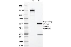 SDS-PAGE Analysis Purified Growth Hormone Mouse Monoclonal Antibody (GH/1371). (Growth Hormone 1 antibody  (AA 58-187))