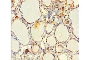 Immunohistochemistry of paraffin-embedded human thyroid tissue using ABIN7151346 at dilution of 1:100