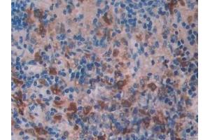 Detection of CTSD in Rat Spleen Tissue using Polyclonal Antibody to Cathepsin D (CTSD)