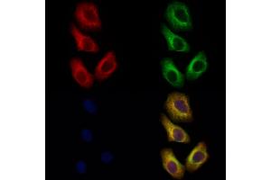 ABIN7093929 and ABIN7097973 staining Hela cells by IF/ICC.