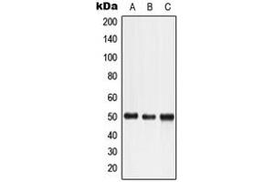 Western blot analysis of LTBR expression in HeLa (A), HuT78 (B), K562 (C) whole cell lysates. (LTBR antibody  (N-Term))