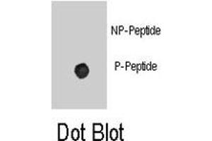 Dot blot analysis of ADRB2 (phospho S261) polyclonal antibody  on nitrocellulose membrane. (beta 2 Adrenergic Receptor antibody  (pSer261))