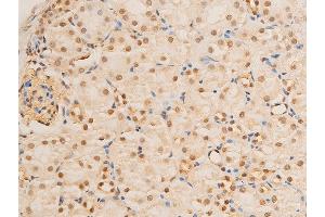 Immunohistochemistry (IHC) image for anti-Forkhead Box O3 (FOXO3) (pSer253) antibody (ABIN6255131)