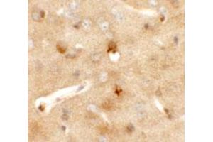 Immunohistochemical staining of mouse brain cells with CCDC141 polyclonal antibody  at 5 ug/mL. (CCDC141 antibody  (N-Term))