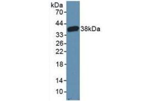 Western blot analysis of recombinant Mouse CARD9.