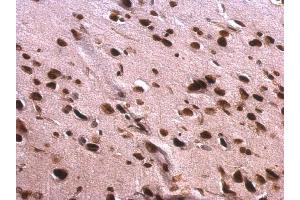 IHC-P Image Scaffold attachment factor B1 antibody detects Scaffold attachment factor B1 protein at nucleus on rat fore brain by immunohistochemical analysis. (SAFB antibody)
