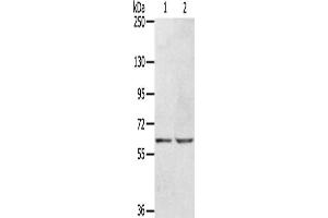 Gel: 6 % SDS-PAGE, Lysate: 40 μg, Lane 1-2: Hepg2 cells, HT29 cells, Primary antibody: ABIN7129957(KCNH6 Antibody) at dilution 1/400, Secondary antibody: Goat anti rabbit IgG at 1/8000 dilution, Exposure time: 30 seconds (KCNH6 antibody)