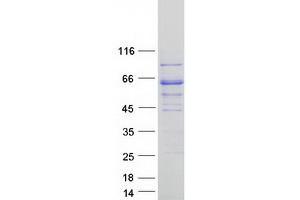 Validation with Western Blot (RFTN2 Protein (Myc-DYKDDDDK Tag))