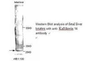 Image no. 1 for anti-Kallikrein 14 (KLK14) antibody (ABIN790854) (Kallikrein 14 antibody)