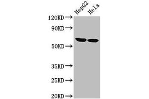 Western Blot Positive WB detected in: HepG2 whole cell lysate, Hela whole cell lysate All lanes: CKAP4 antibody at 2. (CKAP4 antibody  (AA 260-394))