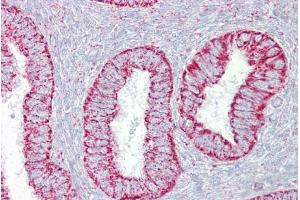 Immunohistochemistry with Uterus tissue at an antibody concentration of 5µg/ml using anti-PDGFB antibody (ARP58509_P050) (PDGFB antibody  (N-Term))