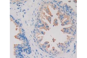 IHC-P analysis of Human Prostate Gland Tissue, with DAB staining. (HIF1AN antibody  (AA 2-349))