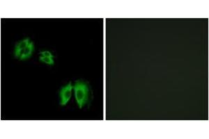 Immunofluorescence analysis of A549 cells, using B3GALT2 Antibody. (B3GALT2 antibody  (AA 373-422))