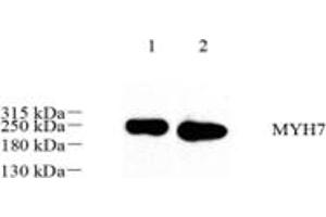 Western blot analysis of MYH7 (ABIN7075622),at dilution of 1: 500,Lane 1: Mouse heart tissue lysate,Lane 2: Rat muscle tissue lysate (Slow Skeletal Myosin Heavy Chain antibody)