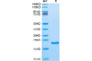 Biotinylated Human IL-21 on Tris-Bis PAGE under reduced condition. (IL-21 Protein (AA 32-162) (His-Avi Tag,Biotin))