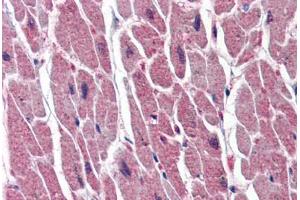 Human Heart (formalin-fixed, paraffin-embedded) stained with UNG antibody ABIN364332 at 10 ug/ml followed by biotinylated anti-mouse IgG secondary antibody ABIN481714, alkaline phosphatase-streptavidin and chromogen. (UNG antibody  (AA 1-313))