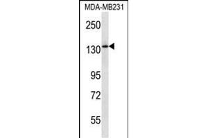 PIK3R4 Antibody (Center) (ABIN657232 and ABIN2837913) western blot analysis in MDA-M cell line lysates (35 μg/lane). (PIK3R4 antibody  (AA 819-847))