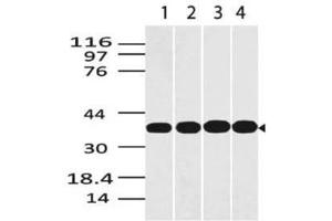 Image no. 1 for anti-Glyceraldehyde-3-Phosphate Dehydrogenase (GAPDH) (AA 120-320) antibody (ABIN5027214) (GAPDH antibody  (AA 120-320))