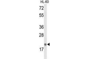 Western blot analysis of IL26  (arrow) in HL-60 cell line lysates (35ug/lane) using Interleukin-26 / IL26 