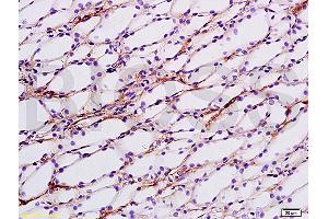 Formalin-fixed and paraffin embedded rat kidney tissue labeled with Anti-ENaCg/? (SCNN1G antibody  (AA 188-290))