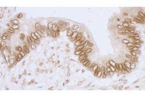 anti-LAP2 beta gamma/tmpo (AA 350-400) antibody