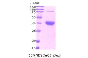 SDS-PAGE (SDS) image for Baculoviral IAP Repeat-Containing 7 (BIRC7) (AA 1-298) protein (His tag) (ABIN667709)