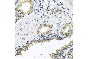 Immunohistochemistry of paraffin-embedded human prostate using STXBP2 antibody at dilution of 1:100 (x40 lens). (STXBP2 antibody)