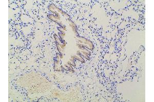 Immunohistochemistry (IHC) image for anti-Ephrin B2 (EFNB2) (C-Term) antibody (ABIN6261455)