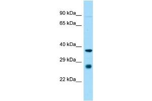 Host:  Rabbit  Target Name:  St8sia1  Sample Type:  Rat Heart lysates  Antibody Dilution:  1. (ST8SIA1 antibody  (Middle Region))