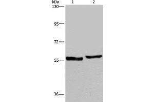 Western Blot analysis of Human testis tissue and A375 cell using SLC1A6 Polyclonal Antibody at dilution of 1:400