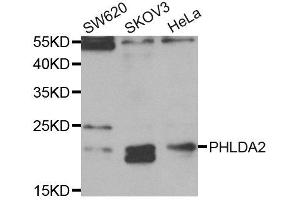 Western Blotting (WB) image for anti-Pleckstrin Homology-Like Domain, Family A, Member 2 (PHLDA2) antibody (ABIN1882371) (PHLDA2 antibody)
