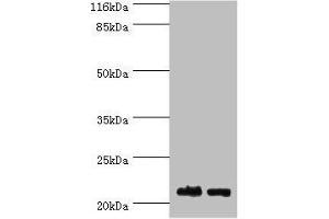 Western blot All lanes: NABP1 antibody at 2 μg/mL Lane 1: Hela whole cell lysate Lane 2: Jurkat whole cell lysate Secondary Goat polyclonal to rabbit IgG at 1/10000 dilution Predicted band size: 23, 14, 15 kDa Observed band size: 23 kDa (OBFC2A antibody  (AA 1-204))