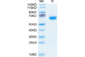 Human LTBR on Tris-Bis PAGE under reduced condition. (LTBR Protein (AA 31-227) (Fc Tag))