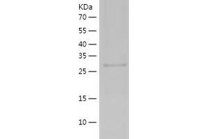 Western Blotting (WB) image for serpin Peptidase Inhibitor, Clade B (Ovalbumin), Member 9 (SERPINB9) (AA 66-328) protein (His tag) (ABIN7286360) (SERPINB9 Protein (AA 66-328) (His tag))