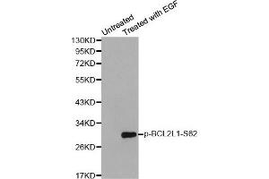 Western Blotting (WB) image for anti-BCL2-Like 1 (BCL2L1) (pSer62) antibody (ABIN1870015) (BCL2L1 antibody  (pSer62))