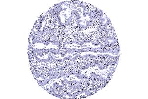 Uterus endometrium In this sample of endometrium nucleolin staining is particularly prominent in the nucleoli of epithelial and stromal cells (Recombinant Nucleolin antibody)