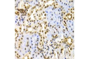 Immunohistochemistry of paraffin-embedded rat kidney using MAPK3 Antibody. (ERK1 antibody)