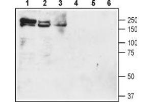 Western blot analysis of rat brain membranes (lanes 1 and 4), mouse brain membranes (lanes 2 and 5) and rat lung lysate (lanes 3 and 6): - 1-3. (SLC12A2 antibody  (6th Extracellular Loop))