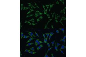 Immunofluorescence analysis of L929 cells using P Polyclonal Antibody (ABIN7269446) at dilution of 1:100 (40x lens). (PABP antibody  (AA 350-450))
