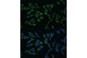 Immunofluorescence analysis of L929 cells using P Polyclonal Antibody (ABIN7269446) at dilution of 1:100 (40x lens).