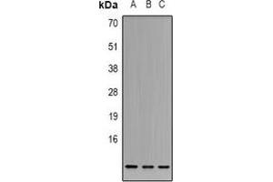 Western blot analysis of Cystatin A expression in K562 (A), HT29 (B), A549 (C) whole cell lysates. (CSTA antibody)